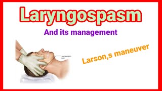 Laryngospasm and its management  Larson maneuver anaesthesiawithbabar2576 [upl. by Liederman]