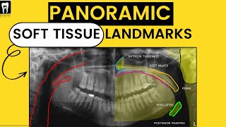 Panoramic Radiography landmarkOrthopantomogramOPG Soft tissue LandmarkAirwayDental Radiology [upl. by Akinoj]