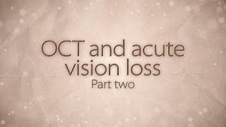 OCT and acute vision loss part two [upl. by Atinaw]