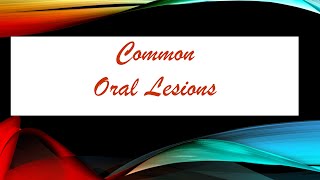 Common Oral Lesions  Definitions [upl. by Estrella]