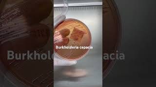 Burkholderia cepacia trên thạch MC BurkholderiaCepacia ViKhuanNguyHiem MacConkey YHoc SucKhoe [upl. by Aciretnahs]