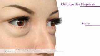 Blépharoplastie Perpignan Docteur Etienne Lanfrey Chirurgien Esthétique [upl. by Rik]