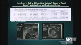 The Role of Endoscopic Ultrasound in the Evaluation of Rectal Cancer [upl. by Aicenaj]