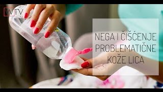 Kako da negujem lice Večernja nega i čišćenje problematične kože lica [upl. by Nnaaras46]