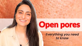 Open pores How to treat  Creams to use  Lasers  Dermatologist Dr Aanchal [upl. by Odraner]