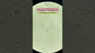 Trichomonas under the microscope Mysophobia Microscope The world under the microscope DOU Good B [upl. by Ahsenwahs]