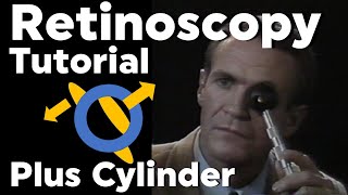 Retinoscopy Plus Cylinder Full Tutorial with Phoropter [upl. by Damian]