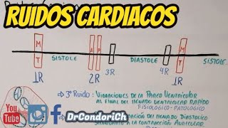 Ruidos Cardiacos Facil explicacion R1R2R3R4 [upl. by Tterraj23]