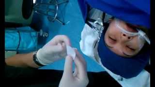 how to prevent the exposure keratitis or protect eyes during the general anesthesia [upl. by Yvan]