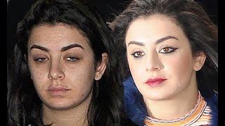 YOU WONT BELIEVE IT KYLIE JENNER CHARLIE XCX BEYONCE AFTER PLASTIC SURGERY [upl. by Parfitt]