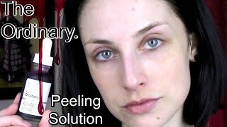 THE ORDINARY Peeling Solution  Before amp After on Dry Skin w Next Day CheckIn [upl. by Arabelle413]