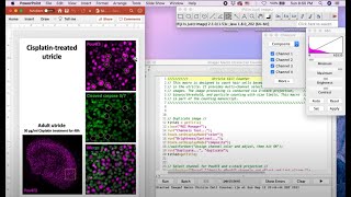 ImageJ Macro Cell Counter Instructional Video [upl. by Dorree]