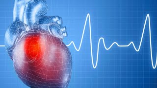 J’ai encore des extrasystoles après une ablation de tachycardie  échec de l’ablation [upl. by Connie]