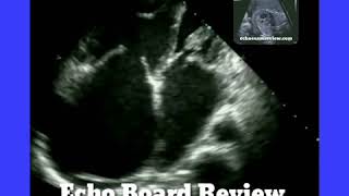 Echocardiography [upl. by Pryor]