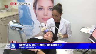 New Skin Tightening Treatment Exilis Ultra Face [upl. by Ilatan917]