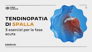 3 esercizi per la tendinopatia acuta di spalla [upl. by Laved181]