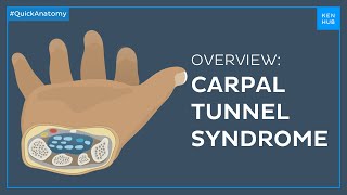 Carpal tunnel syndrome Symptoms causes treatment  Quick Anatomy  Kenhub [upl. by Azmuh756]