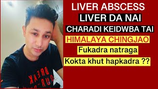 Liver abscess Liver da nai chaba [upl. by Lebasiairam779]