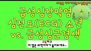 급성심장막염Acute pericarditis의 심전도ECG와 STEMI 감별 Reciprocal change [upl. by Shari458]