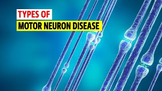 Types of Motor neuron disease [upl. by Eibrab]