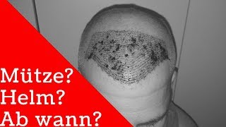 Haartransplantation Erfahrung  Kopfbedeckung  ab wann wieder Mütze oder Helm tragen [upl. by Mireille218]