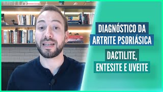 ARTRITE PSORIÁSICA DACLITE ENTESITE E UVEITE [upl. by Justinian]