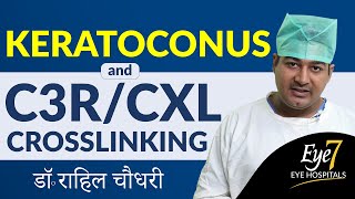 कैसे चुने Keratoconus करैटोकोनस का सही इलाज  C3R TCAT INTACS CONTACT LENS or ICL [upl. by Hameean]