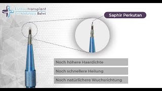 Saphir Perkutan Haartransplantation [upl. by Buskus418]