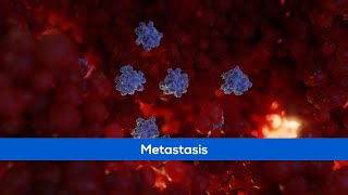 Medical Animation  Cancer Metastasis [upl. by Odnomyar]