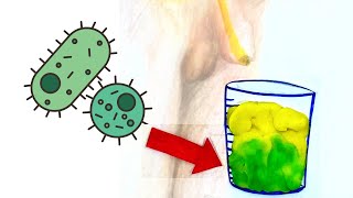 Cómo tomar Muestra de Orina para Urocultivo [upl. by Sasnak510]