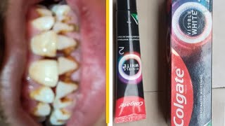 Colgate visible white toothpaste review and unboxing [upl. by Nadabus]