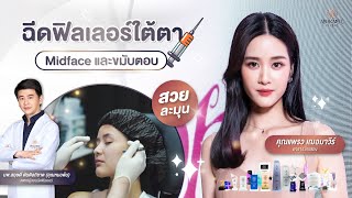 🚩แพรว เฌอมาวีร์ สุวรรณภาณุโชค ดารานักแสดง ไว้วางใจให้ Amarante clinic ฉีดฟิลเลอร์ปรับรูปหน้า [upl. by Yl250]