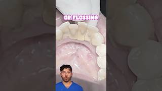 Teeth Cleaning Explained [upl. by Jolee448]