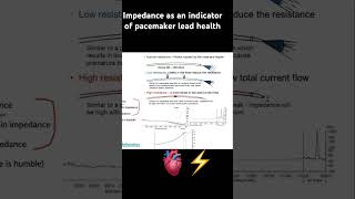 Electrical concepts of cardiac pacing pacemaker education electrophysiology cardiology [upl. by Aiekahs517]