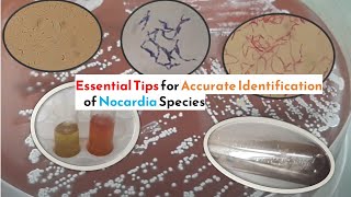 Essential Tips for Accurate Identification of Nocardia Species [upl. by Villiers]