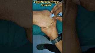 186 IV Cannulation Insertation Technique video [upl. by Schaab]