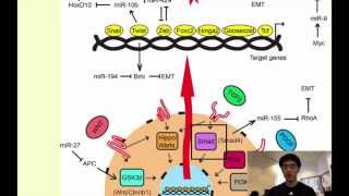 A Novel Form of Cancer Therapy Targeting Metastatic EMT [upl. by Isaacs628]