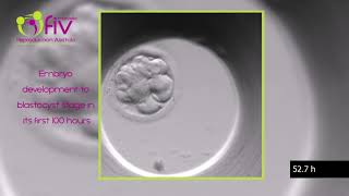 TimeLapse  Embryo development ENG first 100 hours [upl. by Ardeha]