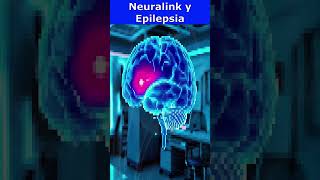 🧠 Neuralink y Epilepsia✨ [upl. by Tippets737]