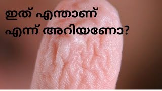 Wrinkled Fingers Born CuriousMalayalam Science video [upl. by Eninahpets]