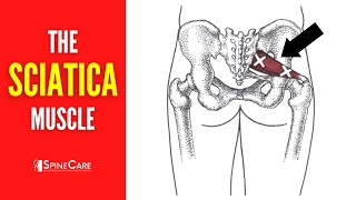 The Sciatica Muscle How to Release It for INSTANT RELIEF [upl. by Adalia]