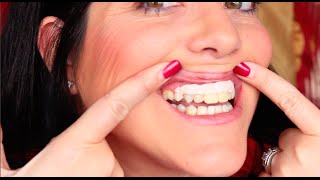 New Teeth Crown Lengthening Surgery Part 2 [upl. by Reichel]