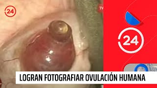 De manera inédita logran fotografiar ovulación humana  24 Horas TVN Chile [upl. by Mccarty]