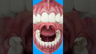 How Tonsil Stones Are Formed short tonsilstones  creativelearning3d [upl. by Luciano53]