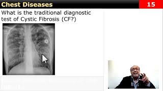 Clinical Case Chest Quick question internalmedicine cme usmle محاضراتباطنة [upl. by Mellar186]