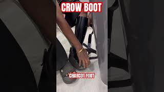 CROW BOOT  doctorabin  bestorthodoctor footcondition orthopedics orthopedicsurgeon [upl. by Ecreip]