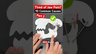 Part 2 of 2 10 Types of Jaw Pain tmj tmd jawpain jawpainrelief dentist dental [upl. by Nyrhtak]