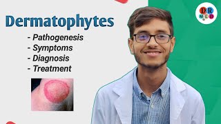 Dermatophytosis  Cutaneous mycosis  Dermatophytes  Microbiology bangla lecture [upl. by Nellak31]