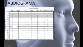 Interpretación de Audiometrías Normales Guía para Entender los Resultados [upl. by Cassiani]