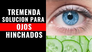 ✔ PAPA Y PEPINO  La Solucion para Eliminar OJOS HINCHADOS Sin Usar QUIMICOS desinflamar [upl. by Vernon318]